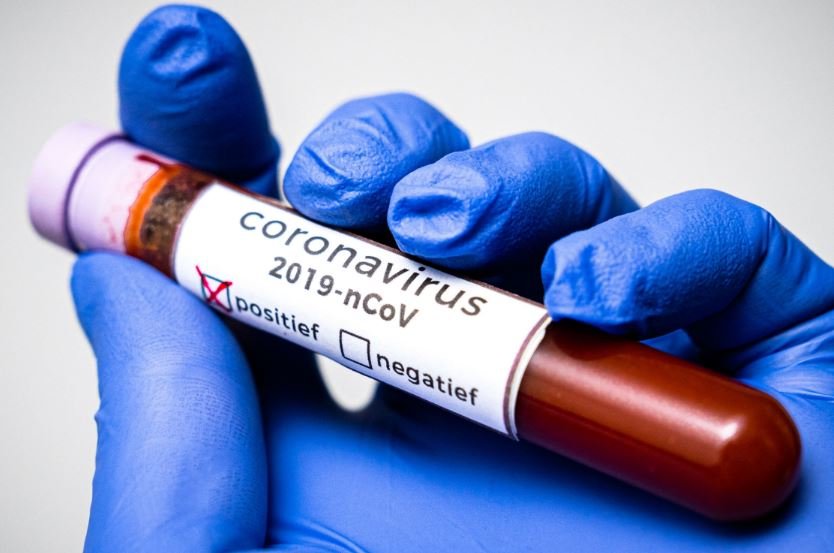 В Беларуси выявлено три разных варианта коронавируса SARS-COV-2