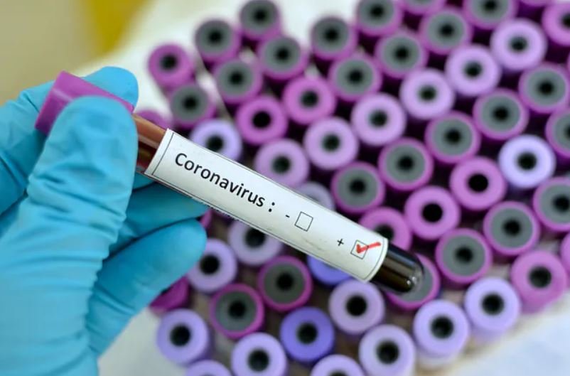 Число зараженных коронавирусом в Беларуси выросло до 3728 человек