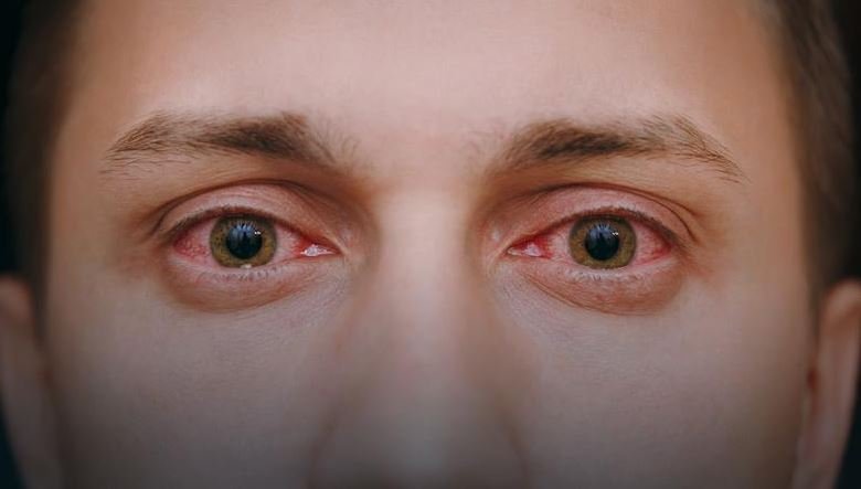 Обнаружена способность коронавируса COVID-19 поражать органы зрения