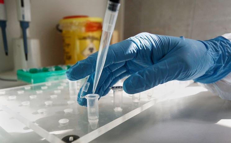 В Беларусь поступили 100 тысяч экспресс-тестов на антитела к коронавирусу