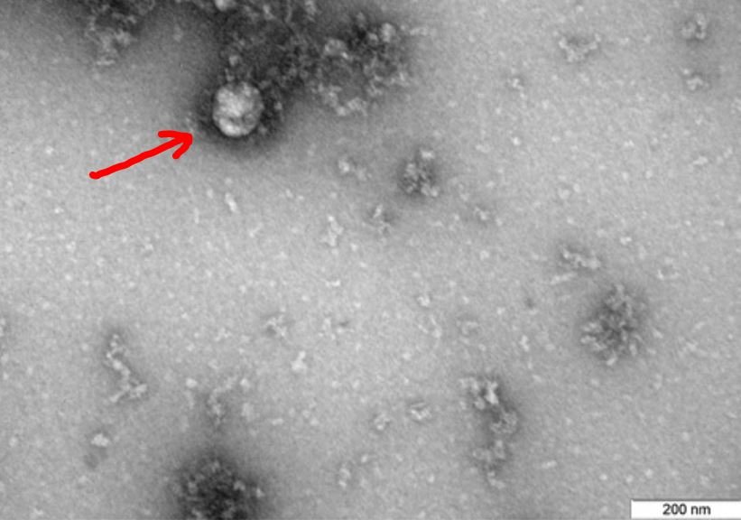 Ученые опубликовали первое изображение британского штамма вируса