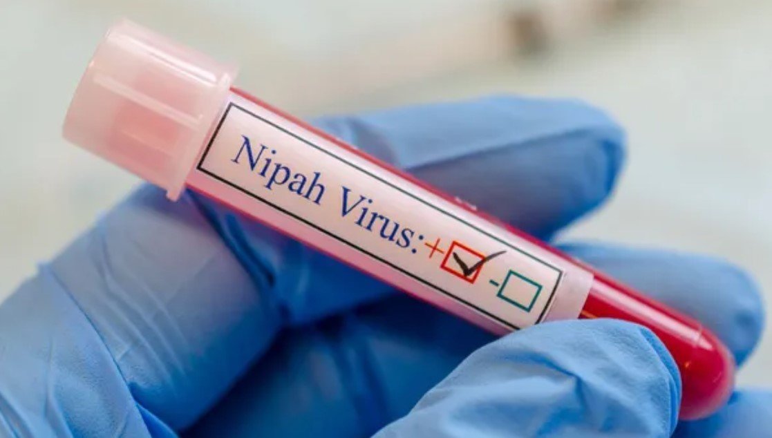 Что известно о смертельном вирусе Нипах?