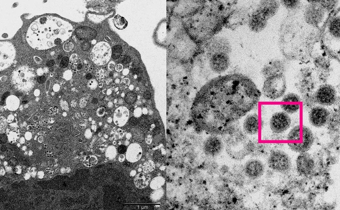 Ученые из Гонконга опубликовал изображение штамма коронавируса «Омикрон»