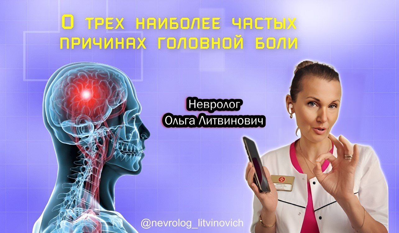 Невролог Литвинович назвала три наиболее частые причины головной боли