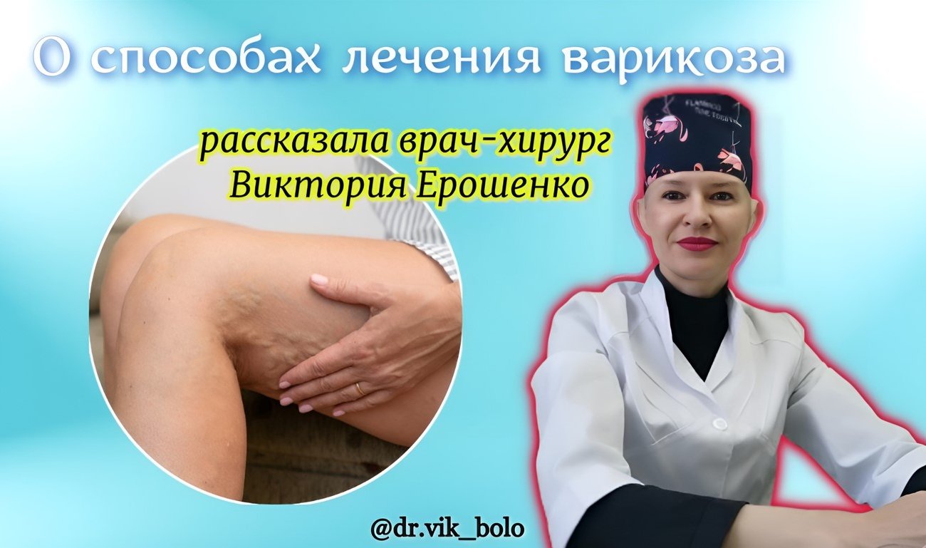 Врач-хирург Ерошенко рассказала о способах лечения варикоза