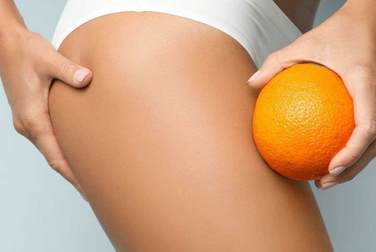 Целлюлит уйдет без изнурительных тренировок: простой способ, который работает