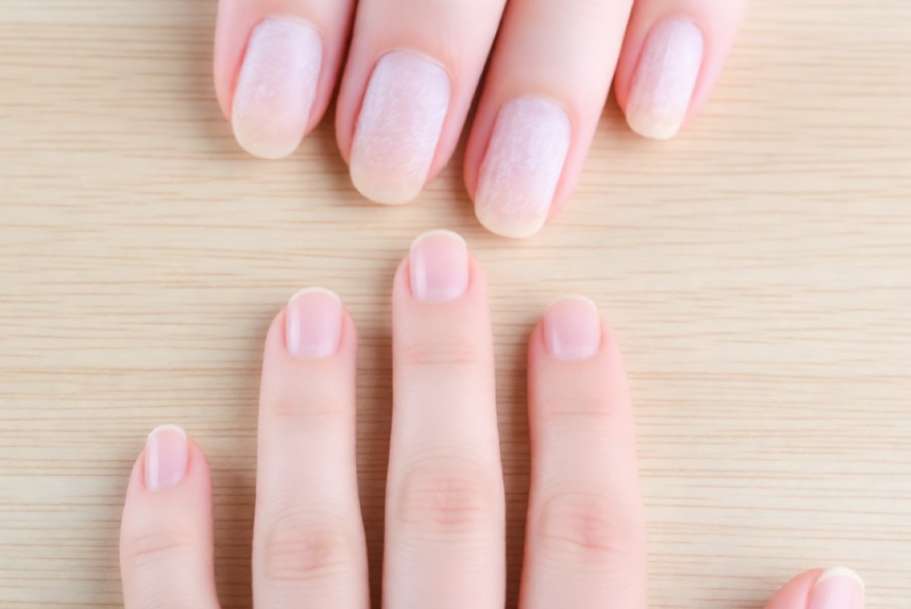 Как вернуть ногтям крепость после гель-лака: работающие домашние методы восстановления
