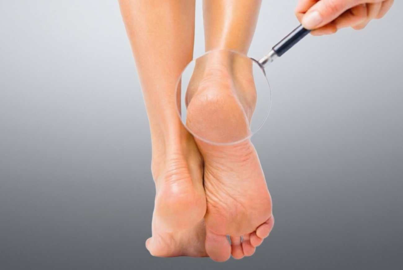 Как привести пятки в порядок без пемзы и дорогих салонов: простой домашний способ