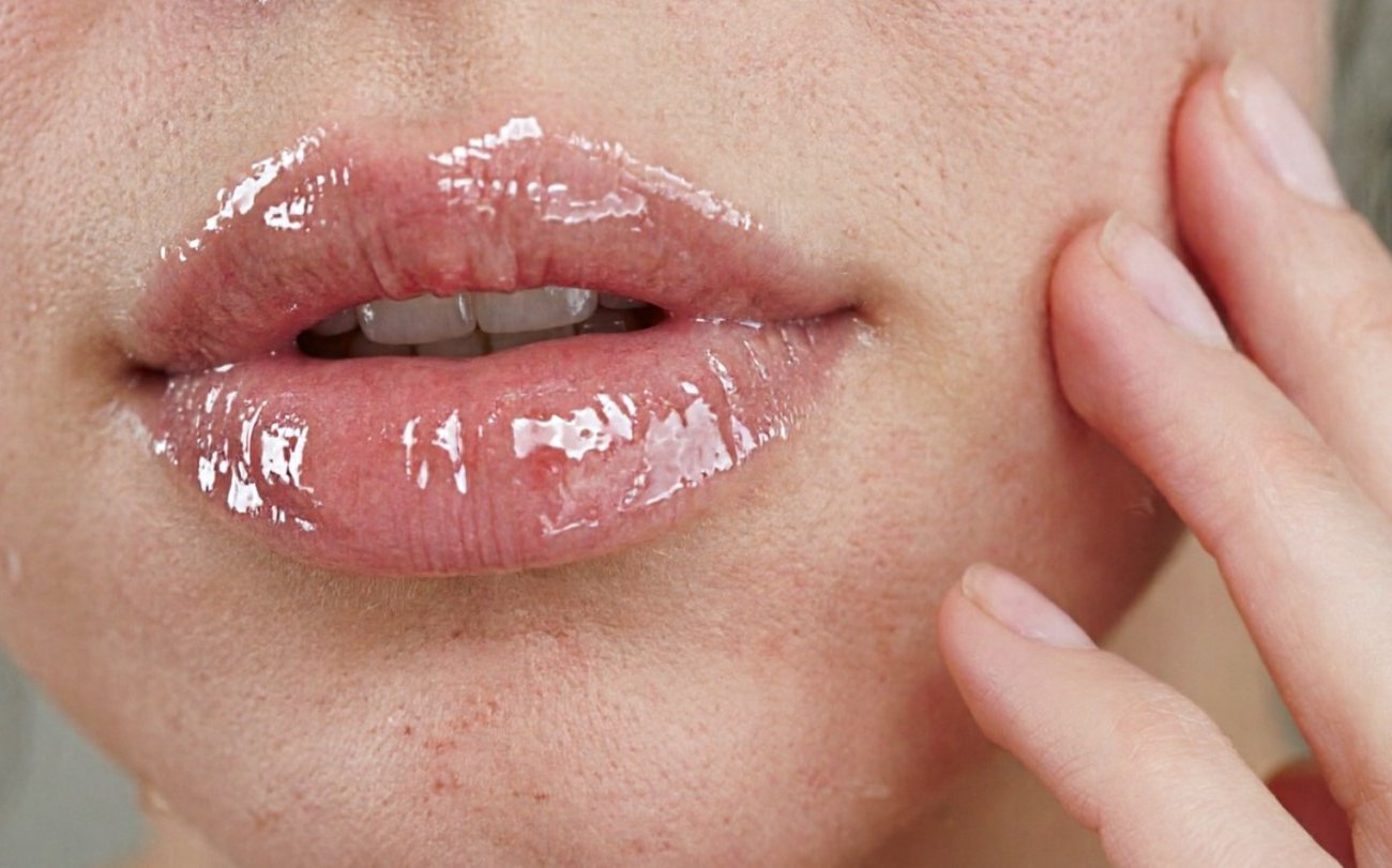 Почему поры расширяются даже при хорошем уходе: пять вещей, которые нельзя делать с кожей